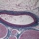 Autofocus HDMI Digital Microscope Camera